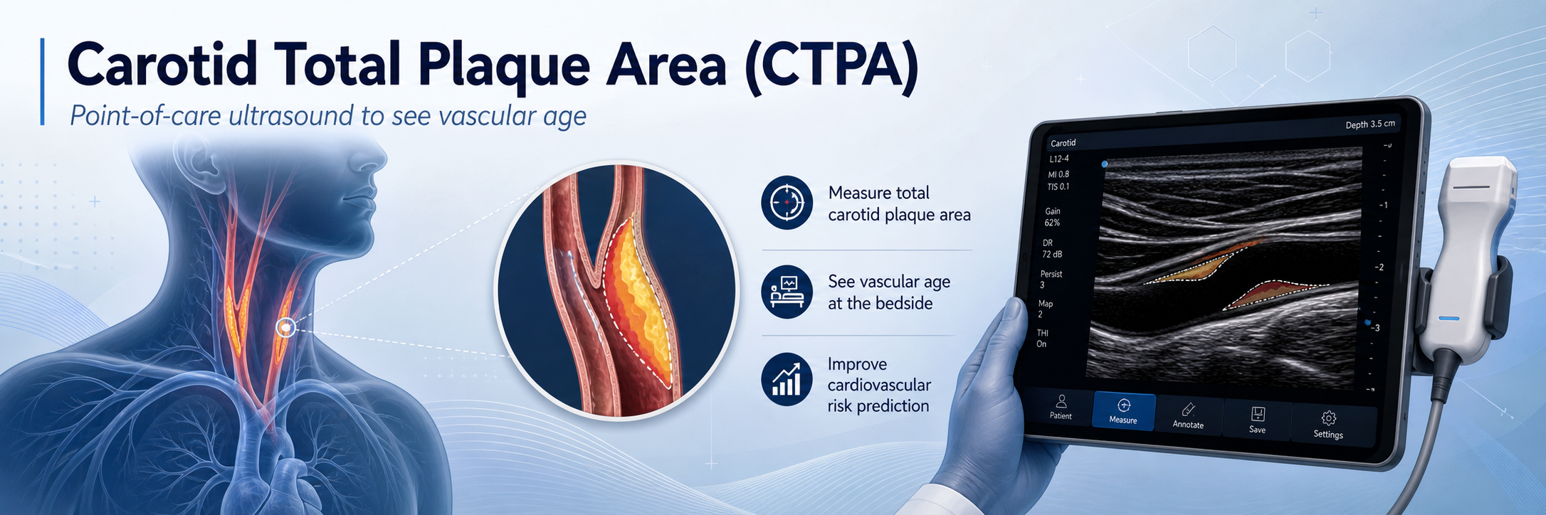 Illustrated CTPA header showing carotid plaque assessment, vascular age, and point-of-care ultrasound.